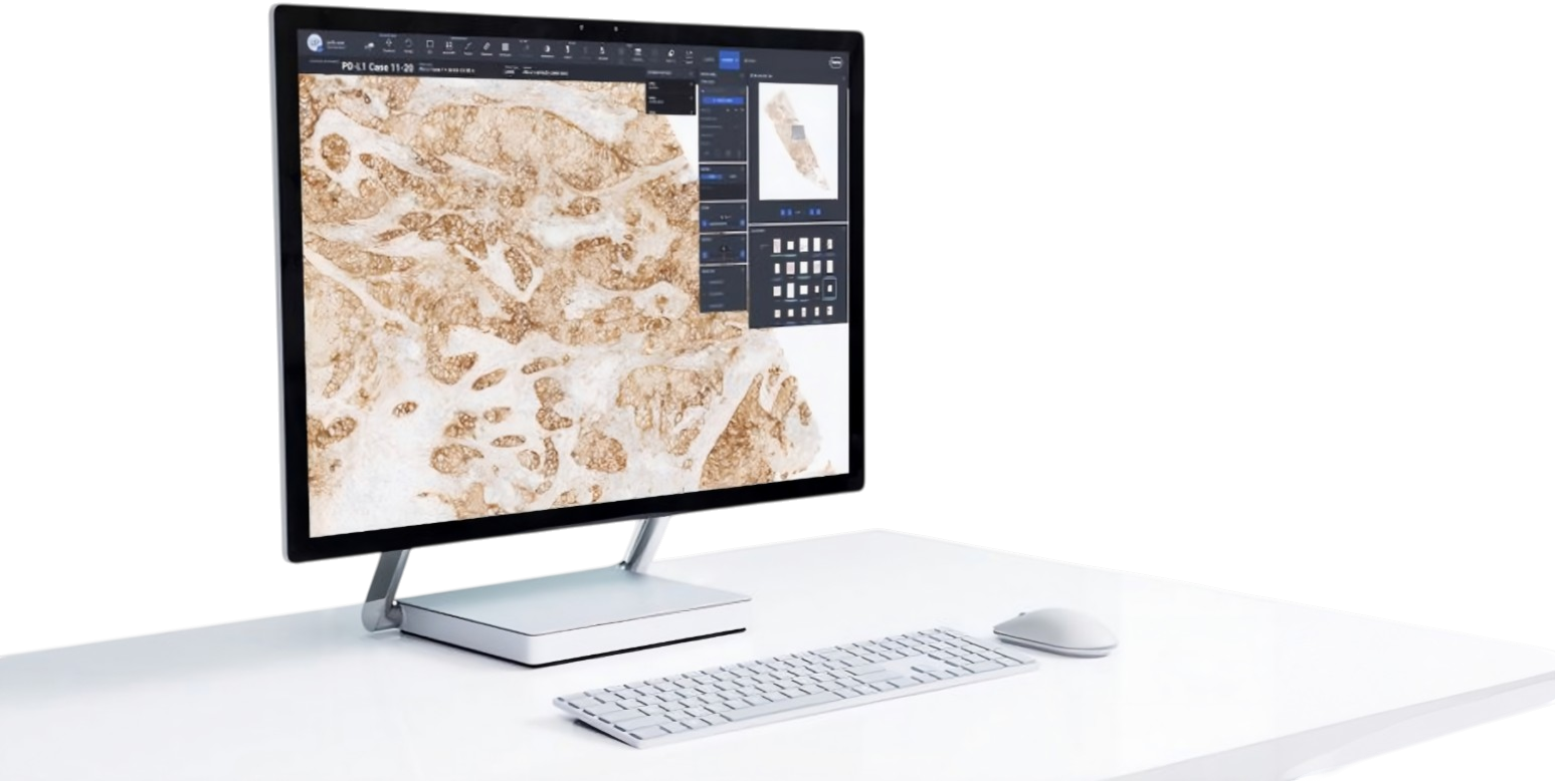 Large monitor showing digital pathology software