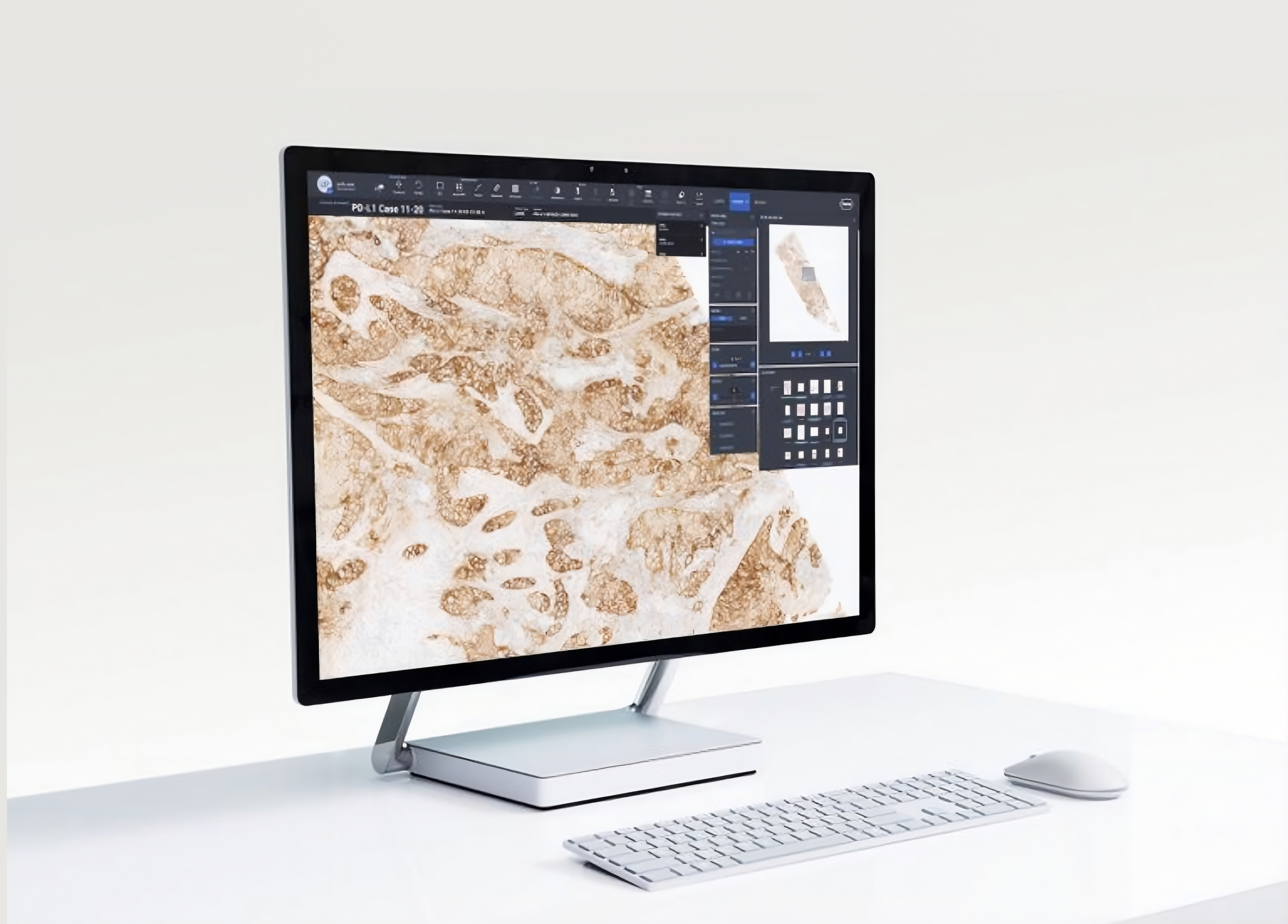 Digital pathology algorithm workflows