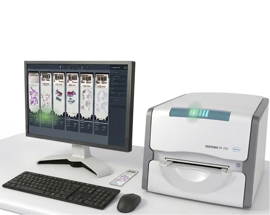 The VENTANA DP 200 scanner alongside a monitor displaying the scan application software — the two surfaces whose status indicators needed to be unified